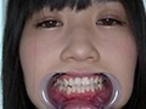 AD-504 sample 3